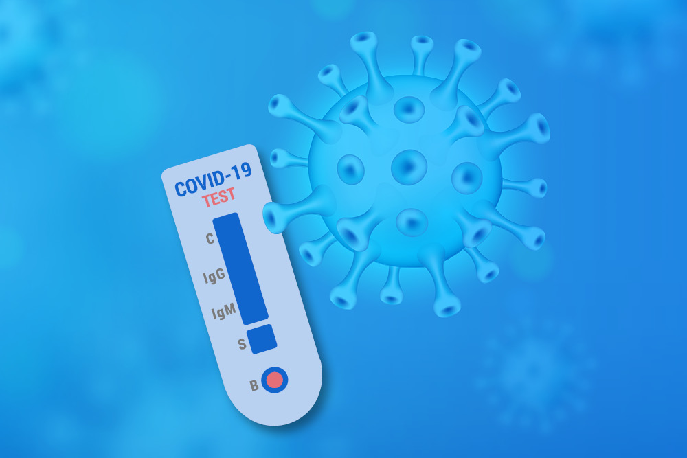 COVID_test_image_2022-05-11_prazen